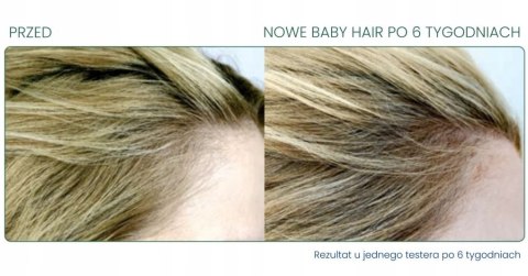 Ampułki przeciw wypadaniu włosów Novaclear Hair 1x5ml